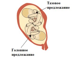 Ябеременна.ру