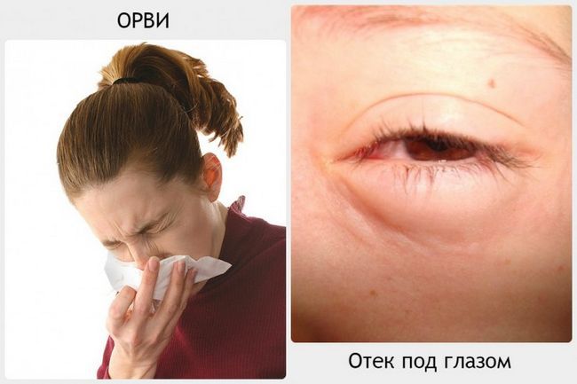 Причини не пов`язані з оком Причини не пов`язані з оком