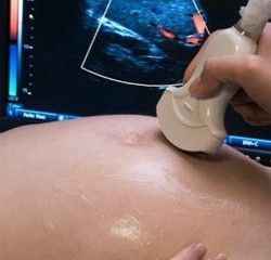 ���� ���� ���� ������
