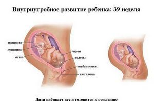 Відійшла пробка болить низ живота