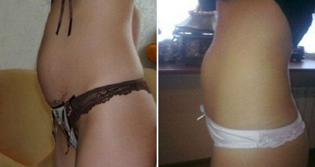 П`ять тижнів вагітності - що відбувається з малюком і мамою