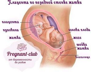 Плацента по передній стінці