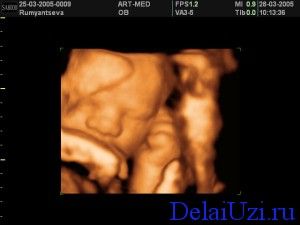 �������� � 32 �����