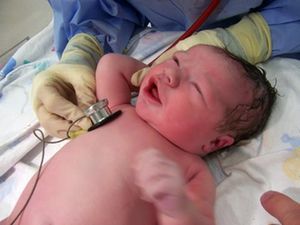 Послід після пологів фото у жінок