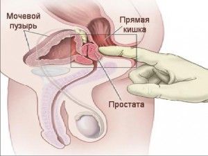 Теми дня: як правильно робити масаж простати, як правильно робити масаж спини, техніка масажу простати
