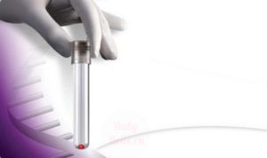 Укол ХГЛ після овуляції навіщо