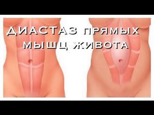 Відео перші пологи жінок