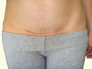 ³��� ������ ���� ������