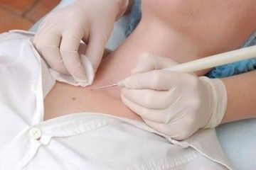 ³��� ������� ������: ������ ���� ��������